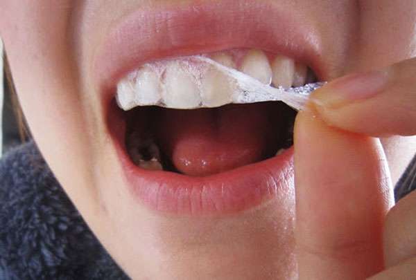 cách sử dụng miếng dán trắng răng 5